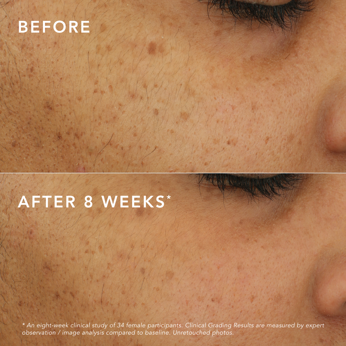 C-Bright Dark Spot Corrector