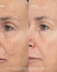 SeneCell™ SenePlex+® StemCell Concentrate MEX