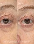 SeneCell™ SenePlex+® StemCell Concentrate MEX