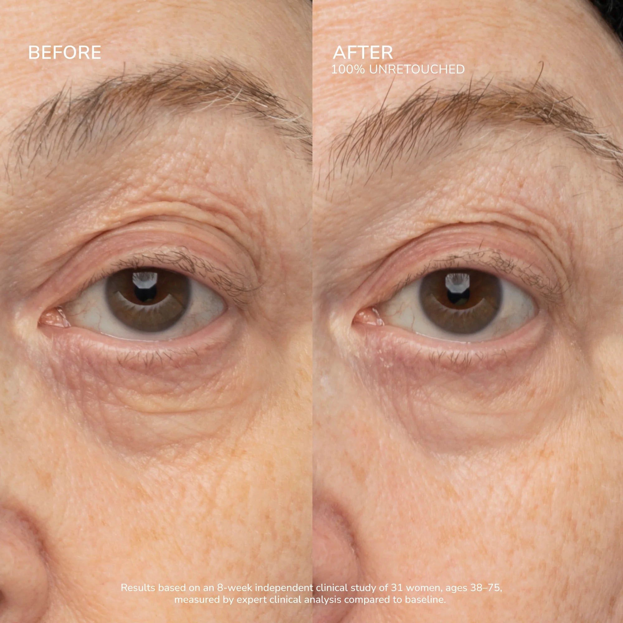 SeneCell™ SenePlex+® StemCell Concentrate
