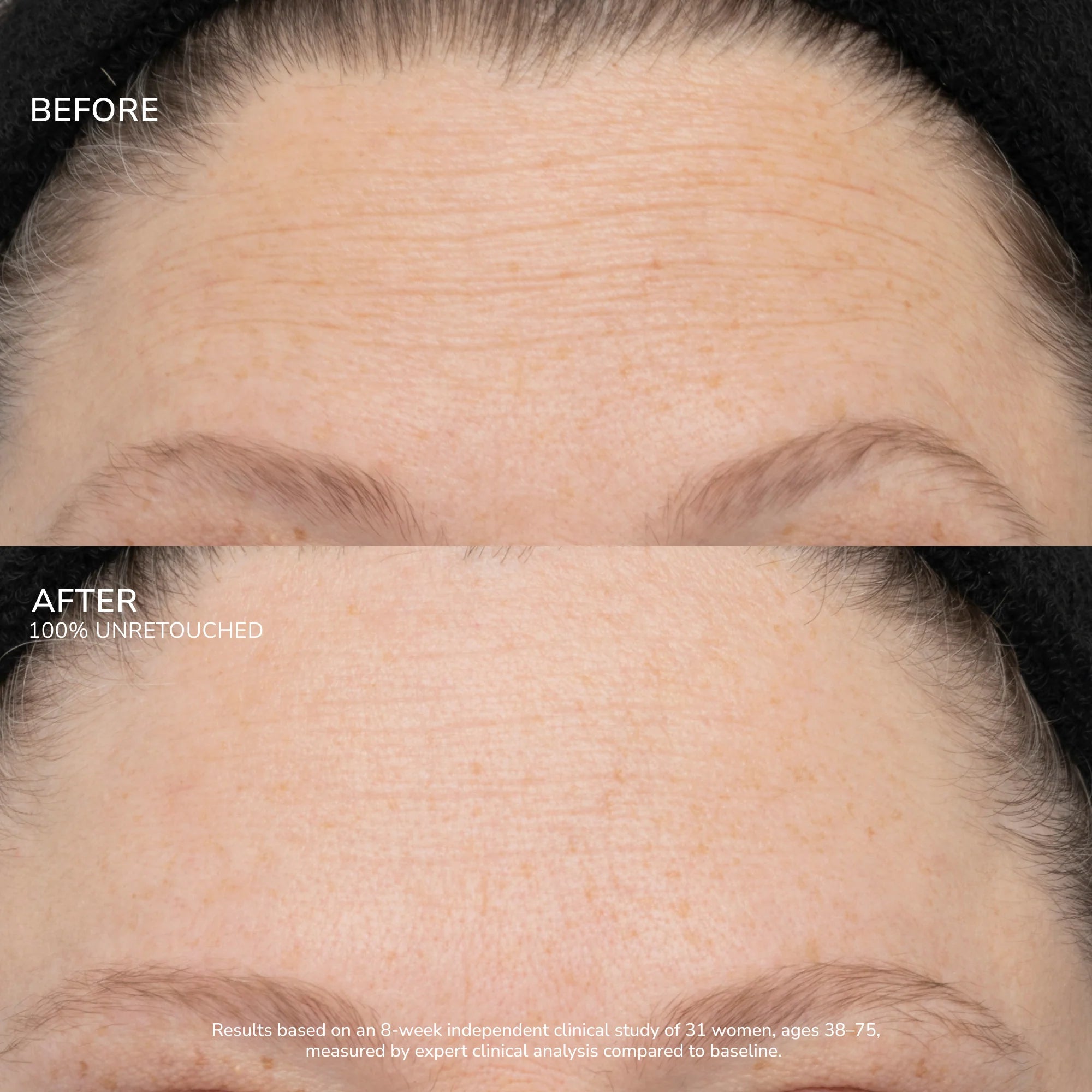 SeneCell™ SenePlex+® StemCell Concentrate MEX