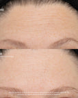 SeneCell™ SenePlex+® StemCell Concentrate MEX
